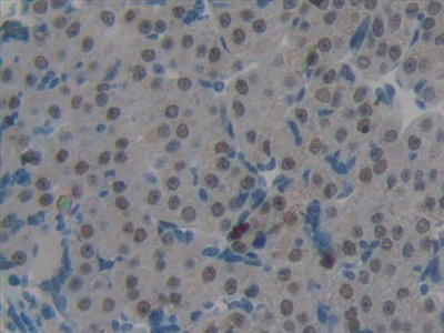 Polyclonal Antibody to Periplakin (PPL)