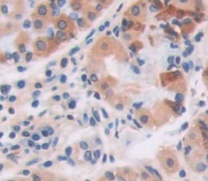 Polyclonal Antibody to Periostin (POSTN)