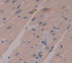 Polyclonal Antibody to Periostin (POSTN)