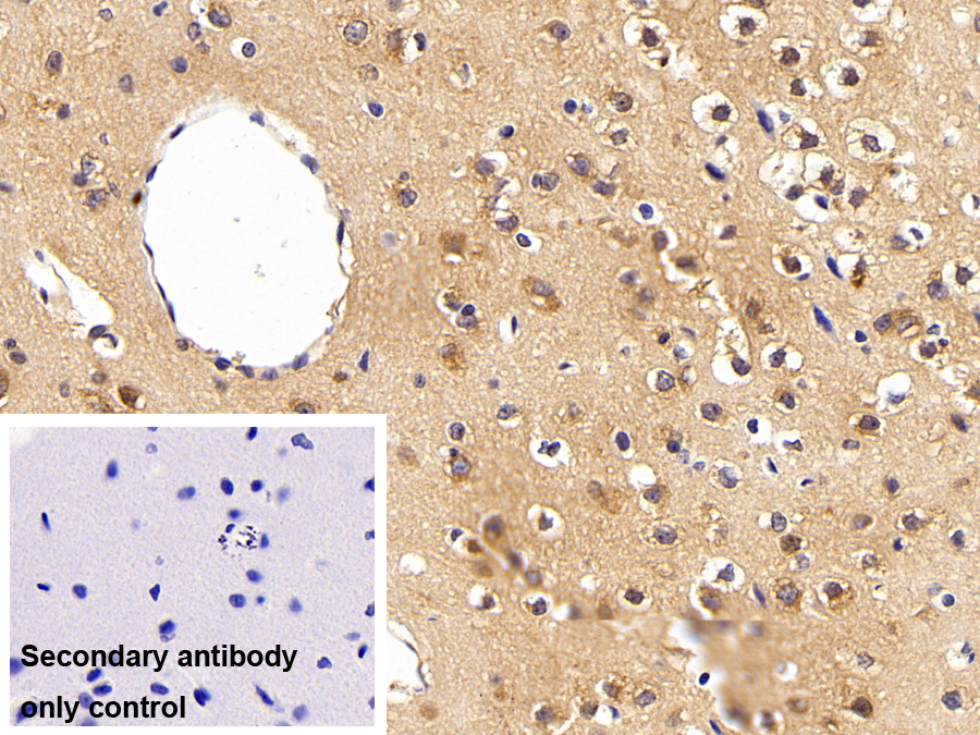 Polyclonal Antibody to Paraneoplastic Antigen MA2 (PNMA2)