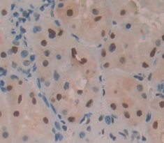 Polyclonal Antibody to Pleiomorphic Adenoma Gene Like Protein 1 (PLAGL1)