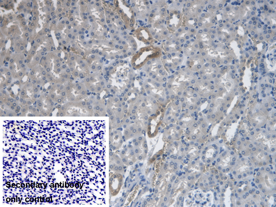 Polyclonal Antibody to Prenylcysteine Oxidase 1 (PCYOX1)