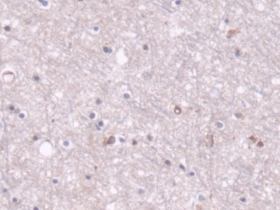 Polyclonal Antibody to Pyruvate Carboxylase (PC)