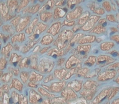 Polyclonal Antibody to Paired Box Gene 9 (PAX9)