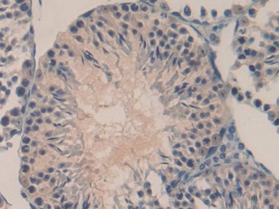 Polyclonal Antibody to Oncomodulin (OCM)