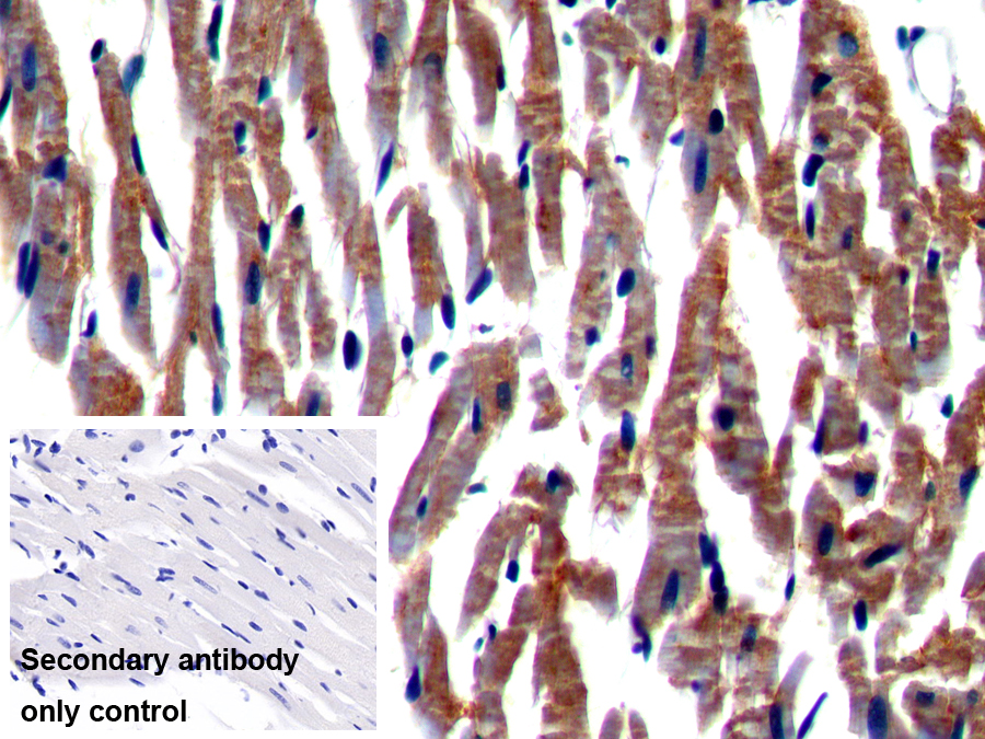 Polyclonal Antibody to Nexilin (NEXN)