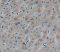 Polyclonal Antibody to N-Acetylgalactosaminidase Alpha (NAGa)