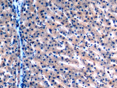 Polyclonal Antibody to Malate Dehydrogenase 2 (MDH2)