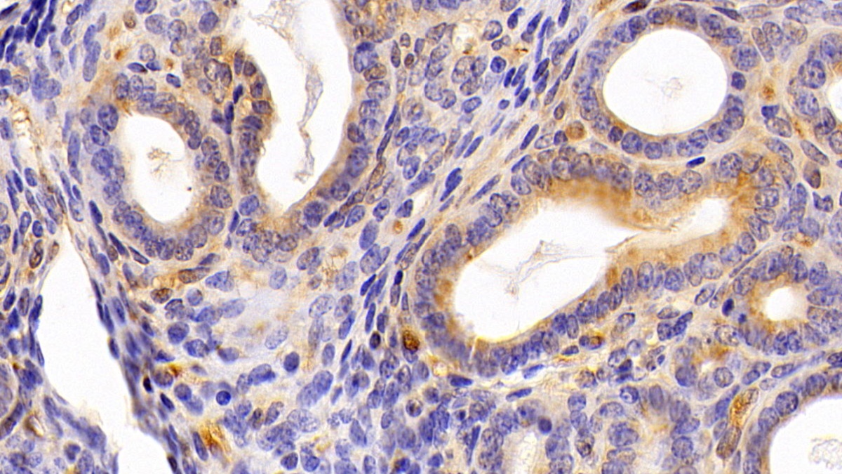 Polyclonal Antibody to Latexin (LXN)