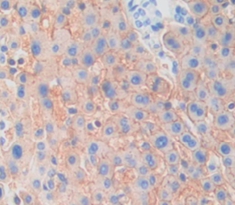 Polyclonal Antibody to Klotho Beta (KLb)