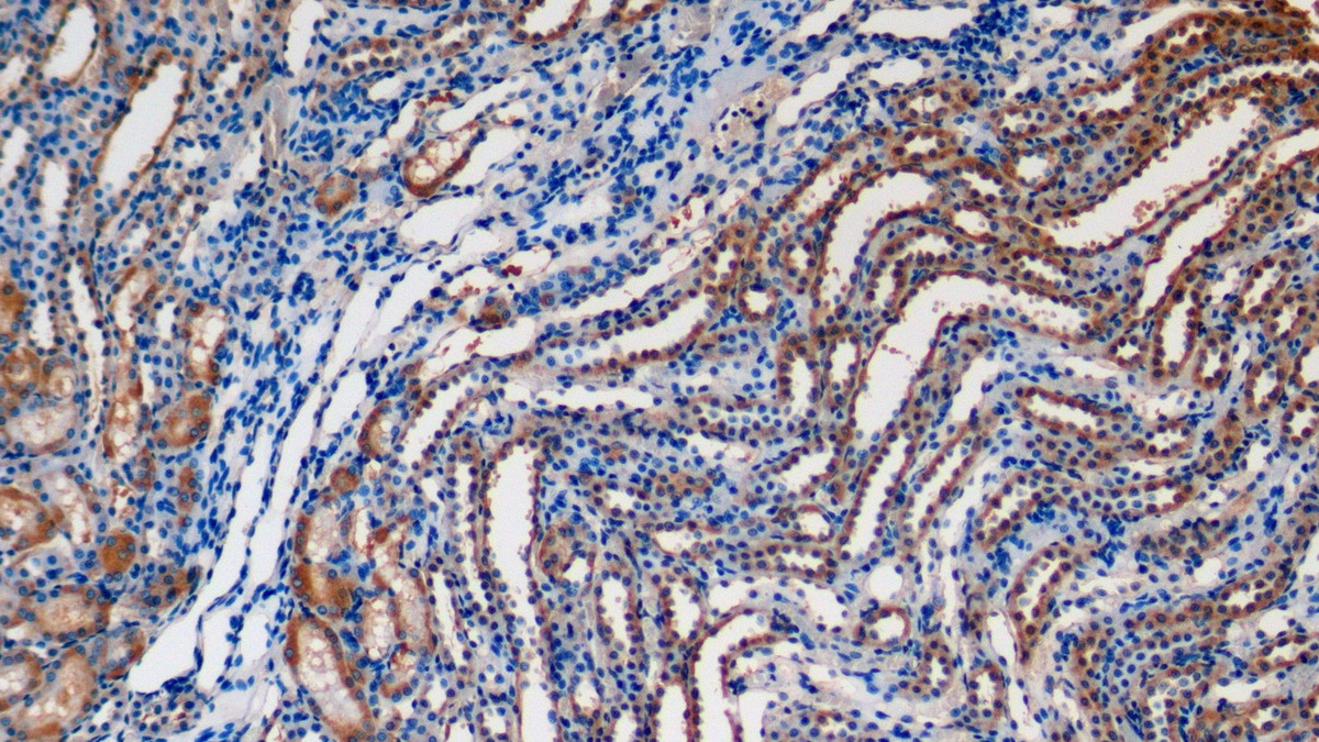 Polyclonal Antibody to Klotho (KL)