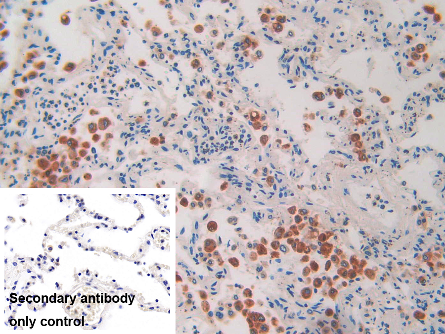 Polyclonal Antibody to Interleukin 1 Receptor Accessory Protein (IL1RAP)