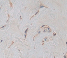Polyclonal Antibody to Hephaestin (HEPH)