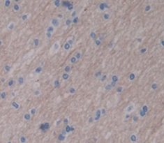 Polyclonal Antibody to Like Glycosyltransferase (LARGE)