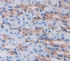 Polyclonal Antibody to Gastrokine 2 (GKN2)