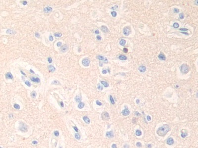 Polyclonal Antibody to Epsin 1 (EPN1)