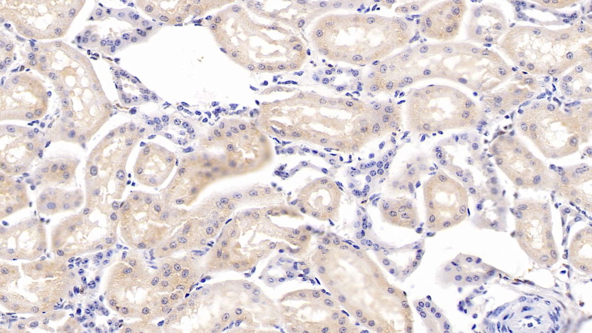 Polyclonal Antibody to Cystatin B (CSTB)