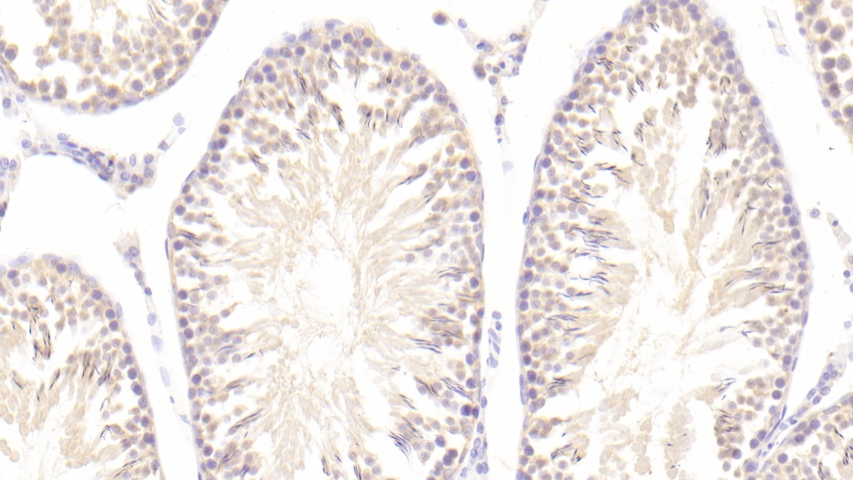 Polyclonal Antibody to Actin Related Protein 2/3 Complex Subunit 4 (ARPC4)