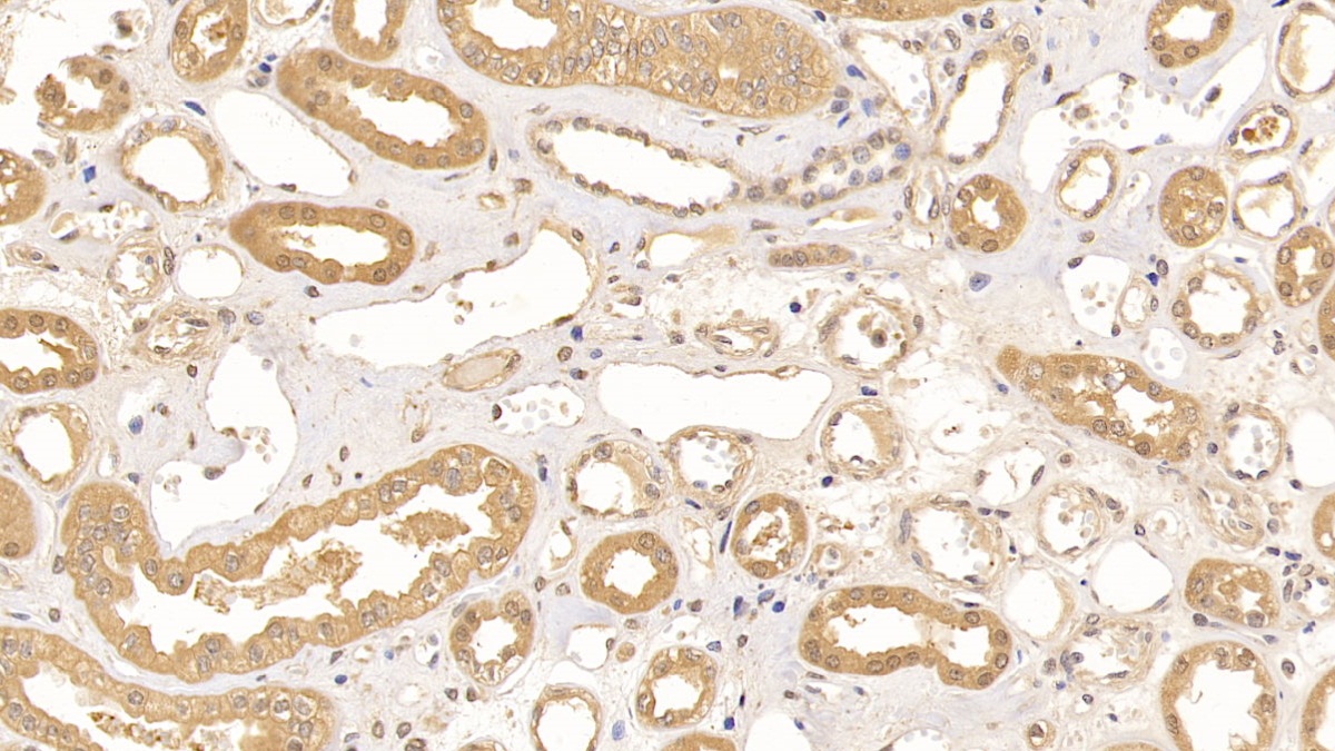 Polyclonal Antibody to Aconitase 1 (ACO1)