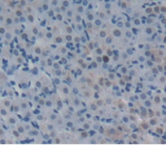 Polyclonal Antibody to Aconitase 1 (ACO1)