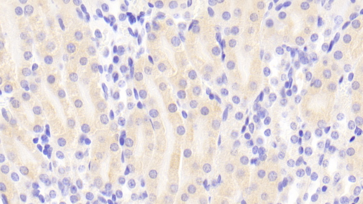 Polyclonal Antibody to Succinate Dehydrogenase Complex Subunit A (SDHA)