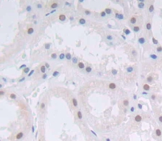 Polyclonal Antibody to Achaete Scute Complex Like Protein 1 (ASCL1)