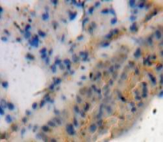Polyclonal Antibody to A Disintegrin And Metalloproteinase With Thrombospondin 4 (ADAMTS4)