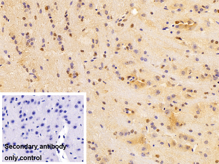 Polyclonal Antibody to Parkinson Disease Protein 7 (PARK7)