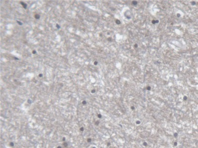 Polyclonal Antibody to Endoplasmic Reticulum Lipid Raft Associated Protein 2 (ERLIN2)