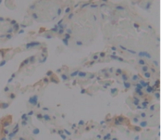 Polyclonal Antibody to Interleukin 1 Family, Member 9 (IL1F9)