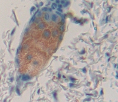 Polyclonal Antibody to Interleukin 1 Family, Member 9 (IL1F9)