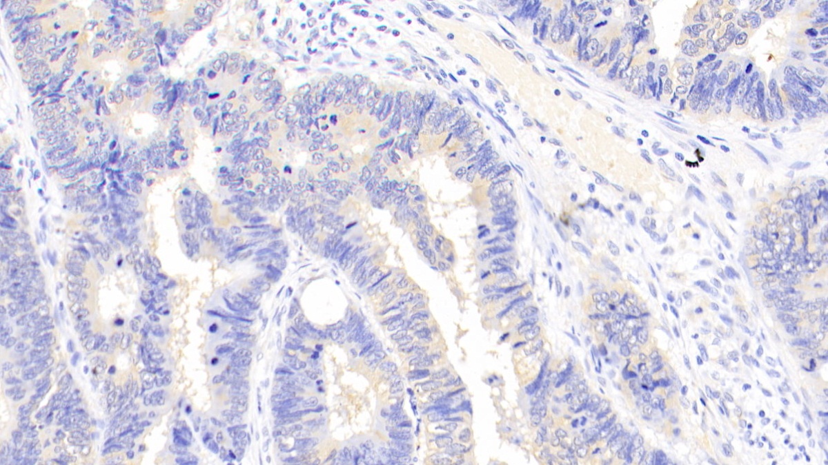 Polyclonal Antibody to Aminoacyl tRNA Synthetase Complex Interacting Multifunctional Protein 1 (AIMP1)