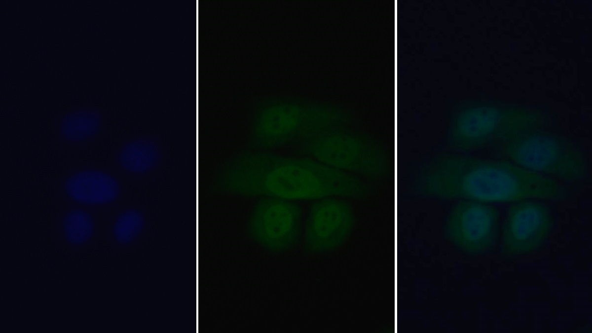 Polyclonal Antibody to Wingless Type MMTV Integration Site Family, Member 1 (WNT1)