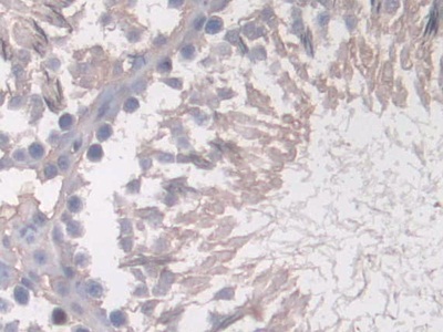 Polyclonal Antibody to N-myc Downstream Regulated Gene 2 (NDRG2)