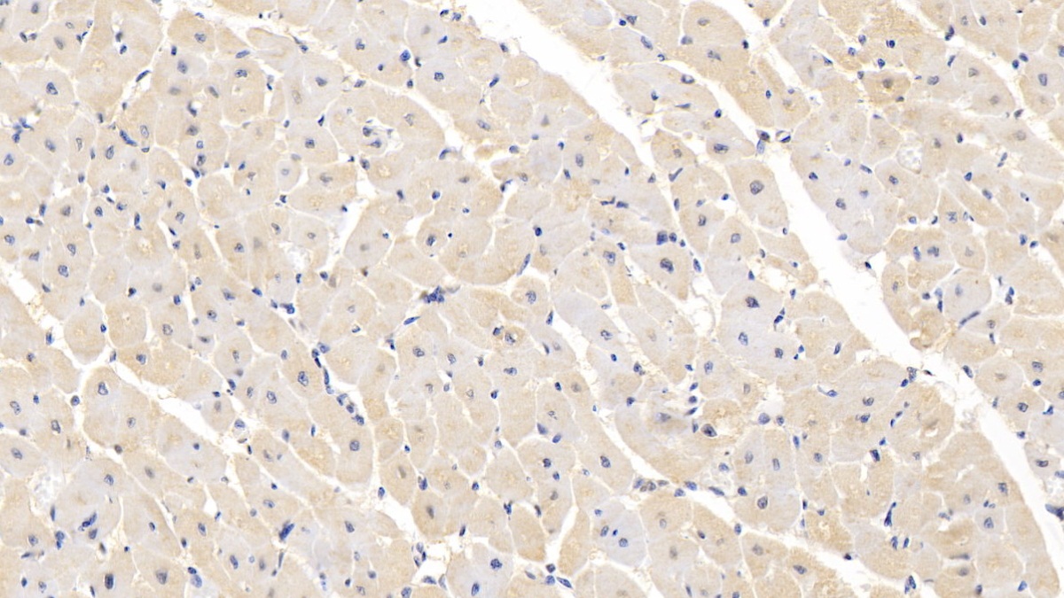 Polyclonal Antibody to Semaphorin 5B (SEMA5B)