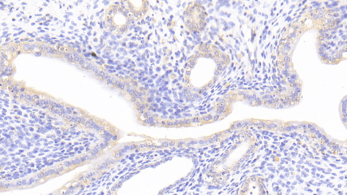 Polyclonal Antibody to Nuclear Factor, Erythroid Derived 2 Like Protein 2 (NFE2L2)