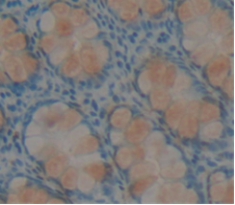 Polyclonal Antibody to Resistin Like Beta (RETNLb)