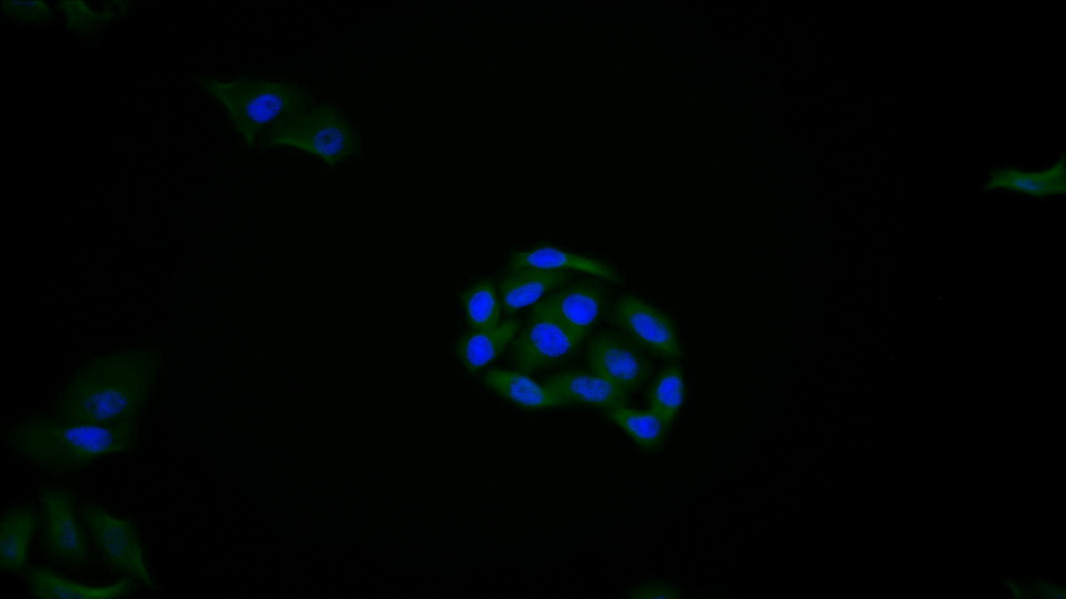 Polyclonal Antibody to REV1 Homolog (REV1)