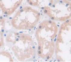 Polyclonal Antibody to Ras Related C3 Botulinum Toxin Substrate 1 (Rac1)