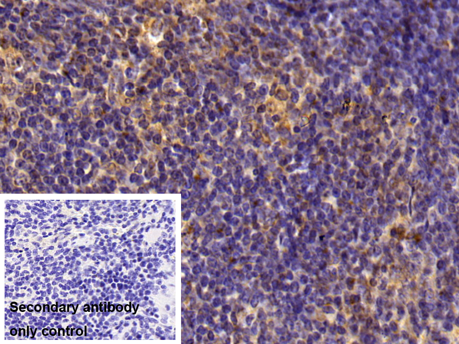 Polyclonal Antibody to T-Cell Immunoreceptor With Ig And ITIM Domains Protein (TIGIT)