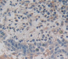 Polyclonal Antibody to Dermokine (DMKN)