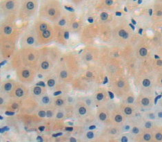 Polyclonal Antibody to Chemokine Like Factor Superfamily 8 (CKLFSF8)