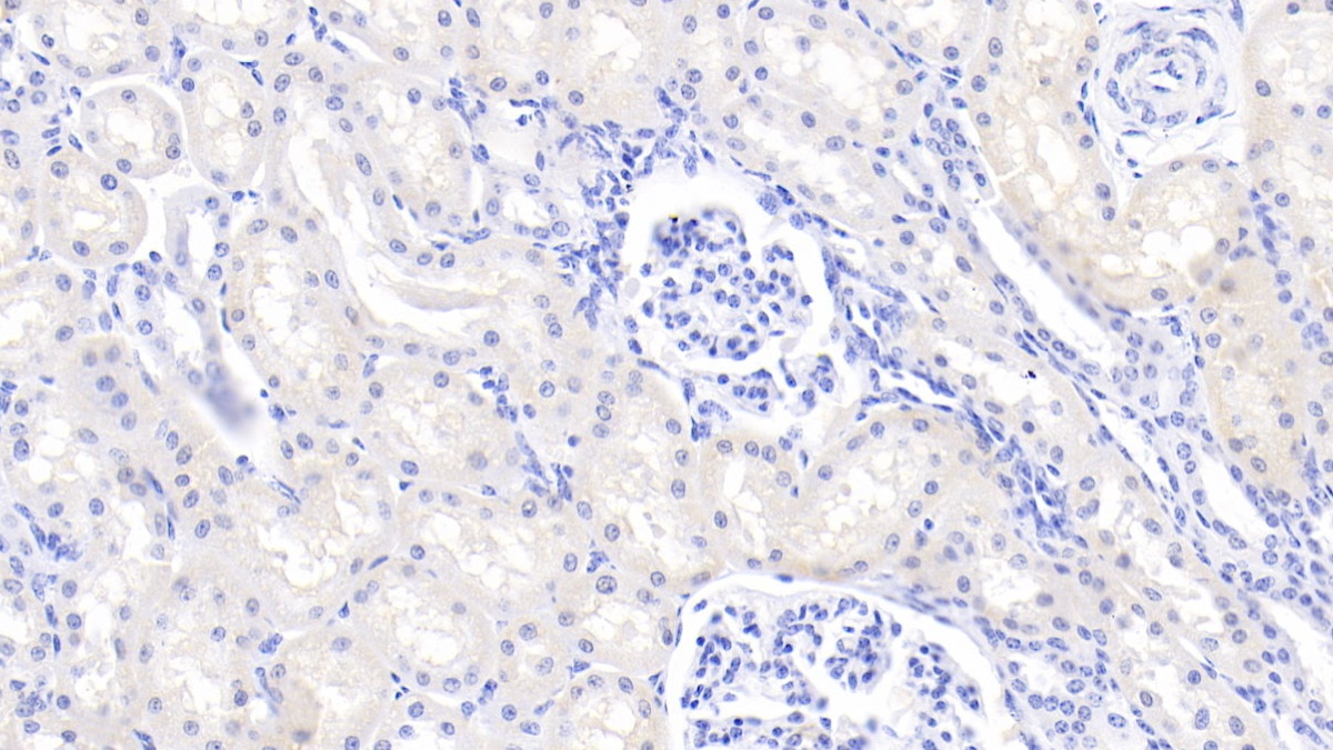 Polyclonal Antibody to Retinol Binding Protein 5, Cellular (RBP5)