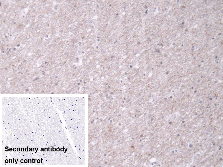 Polyclonal Antibody to Translocase Of Outer Mitochondrial Membrane 70A (TOMM70A)