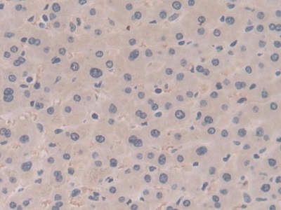 Polyclonal Antibody to Suppression Of Tumorigenicity 14 (ST14)