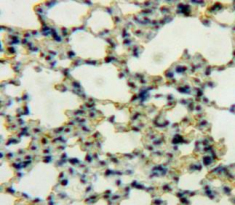 Polyclonal Antibody to Defensin Beta 119 (DEFb119)