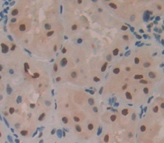 Polyclonal Antibody to Histone Cluster 3, H2a (HIST3H2A)