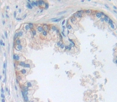 Polyclonal Antibody to Peptidase Inhibitor 16 (PI16)