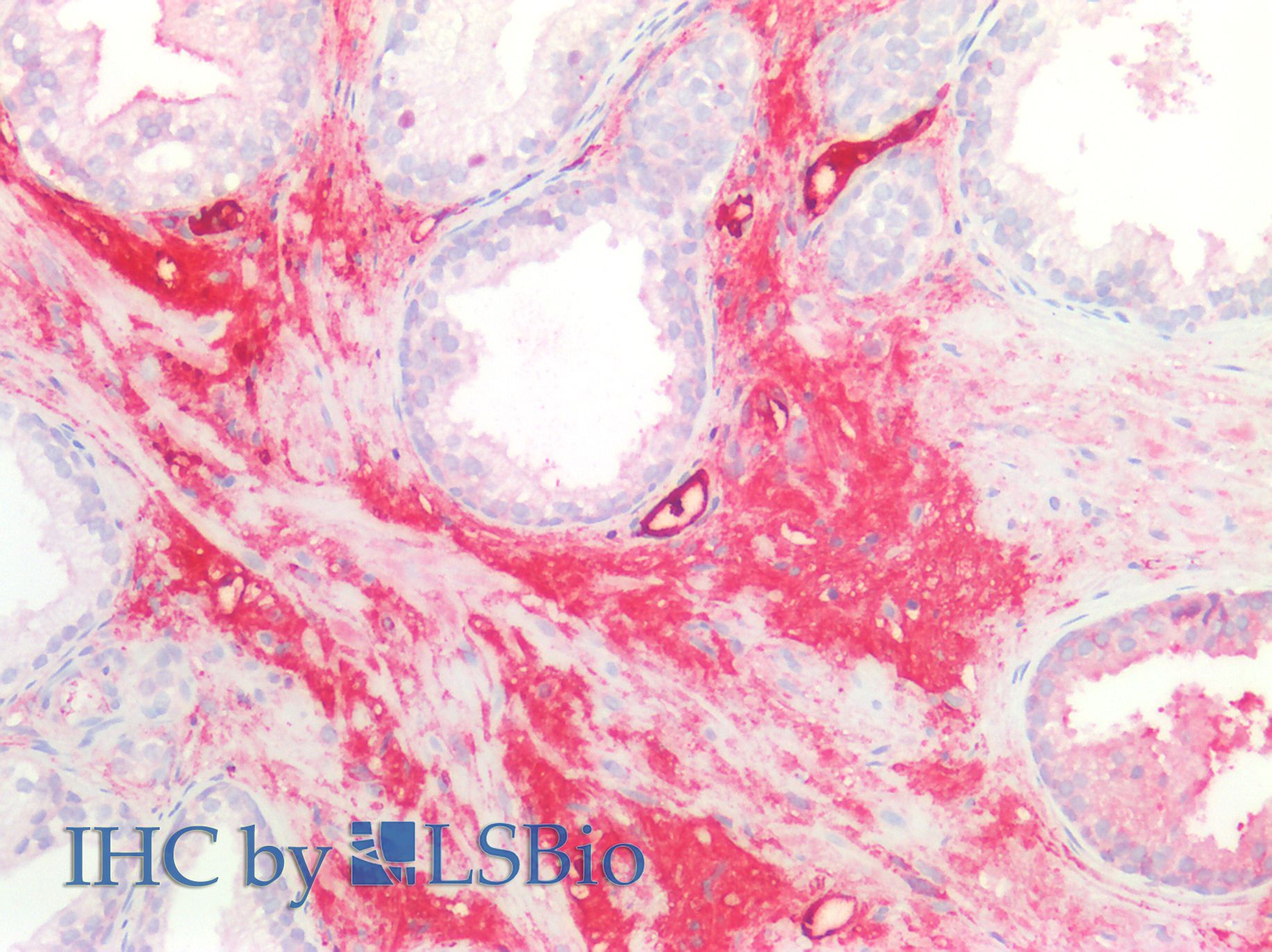 Polyclonal Antibody to Glycosylated Lysosomal Membrane Protein (GLMP)