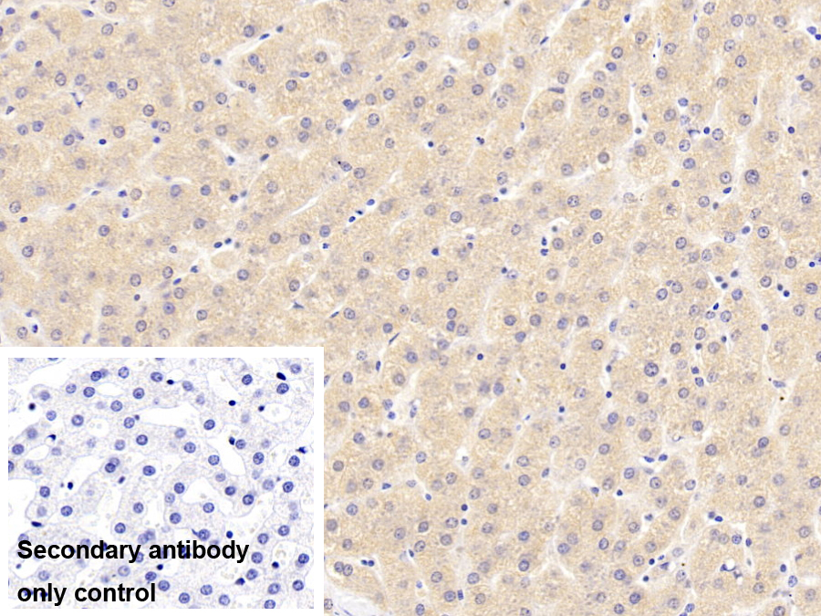 Polyclonal Antibody to Galectin 9C (GAL9C)